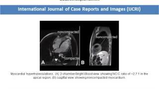 International Journal of Case Reports and Images - Edorium Journals - 2013