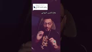 وصفه علاج الشيب النهائي للشعر واللحية