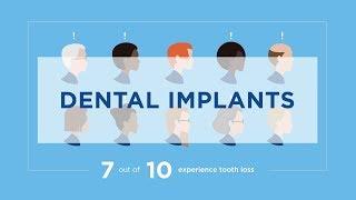 Dental Implants: Long-term Solution (1:09)