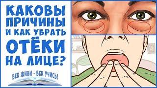 ОТЁКИ. Отёки ЛИЦА. Как убрать отёки на лице. Задержка воды. Вены. Лимфа.