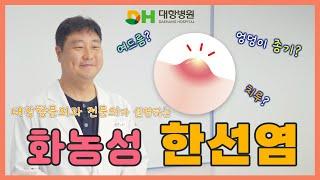 엉덩이 여드름일까? 화농성 한선염! ㅣ 대장항문 전문의가 알려주는 한선염에 모든 것!