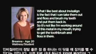 인비절라인인증병원 압구정치과 후즈후치과.wmv