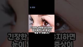 눈 찜질을 꼭 해야 하는 3가지 이유 #눈