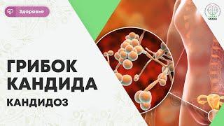 ЗДОРОВЬЕ | Грибок Кандида. Кандидоз. Candida  откуда берется, факторы риска, диагностика.