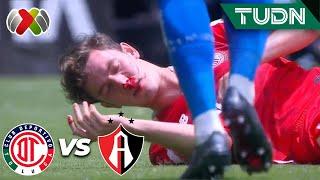 ¡MARCEL RUÍZ cayó con sangre en la nariz!  | Toluca 1-0 Atlas | CL2024 - Liga Mx J14 | TUDN