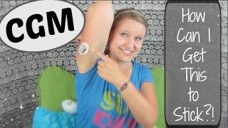 Skin-Tac with the Dexcom CGM!