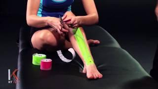 KT Tape: Shin Splints