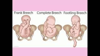 Normal Labor and Delivery - CRASH! Medical Review Series