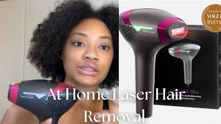 Dermrays At Home Laser Removal Review