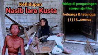 Tidak sampai hati!!Rumah pemukiman kehidupan Eks derita lara Kusta tersisih terasingkan tepi hutan.