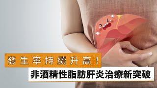 【余明隆醫師】【黃志富醫師】發生率持續升高！　非酒精性脂肪肝炎治療新突破｜健康醫療網