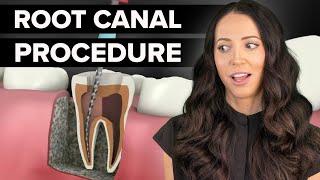 Dental Root Canal Step By Step