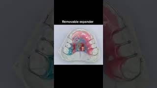 what a removable expander looks like #braces #braceson #bracesoff #retainer #teeth #expander #ortho