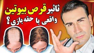 آیا مصرف قرص بیوتین واقعا از ریزش مو جلوگیری میکنه و باعث رشد مجدد مو میشه؟! | Biotin And Hair Loss