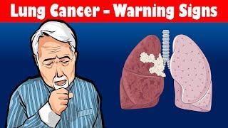 Look Out For These Symptoms, You May Be Having A Lung Cancer!!! Warning Signs Of Lung Cancer