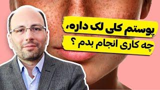 علل ایجاد لکه های پوستی. چی کار کنم رفع بشه؟ 