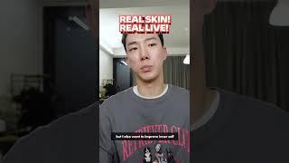 [PreRelease] Trouble Live Vlog  Stay Tuned for THE REAL Skin Changes