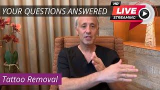 [Your Questions Answered] Tattoo Removal (cost, does it hurt, black skin, alternatives to lasers)