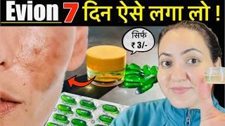 3 रूपए की चीज़ से पाए गोरी निखरी Skin हमेशा के लिए -Vitamin E se झाइयाँ Open Pores Pigmentation गायब