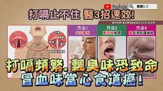 打嗝頻繁 飄臭味恐致命？打嗝看身體健康 冒血味 當心 食道癌 ！ 健康2.0 精華