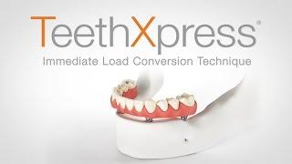 TeethXpress:  Immediate Load Conversion Technique