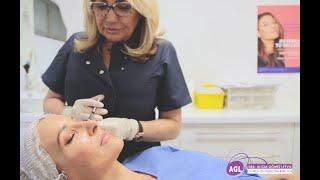 Contorno de ojos con ácido hialurónico || Clínica Dra. Alicia Gómez Leyva