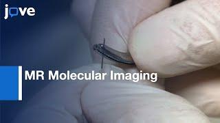 MR Molecular Imaging of Prostate Cancer | Protocol Preview