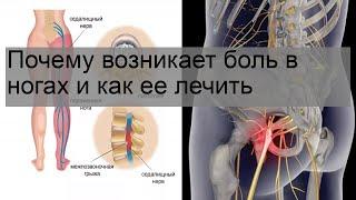 Почему возникает боль в ногах и как ее лечить