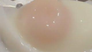 How to poach eggs  perfectly煮荷包蛋的關鍵步驟