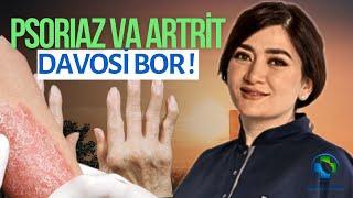 PSORIAZ VA ARTRİT DAVOSI BOR! | Protokol koimbra | Doctor Dilobar