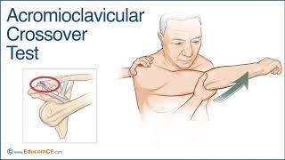 Acromioclavicular Crossover Test - Chiropractic Online CE™