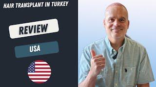 Hair Transplant in Turkey Review l Worbimed Clinic