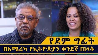 የደም ግፊት፣ በአሜሪካን ሀገር የኢትዮጵያውያን ቀንደኛ ጠላት ።