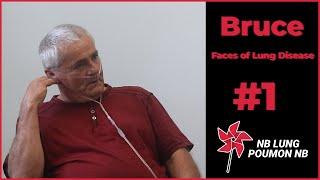 Faces of Lung Disease: Bruce - Living with Lung Disease