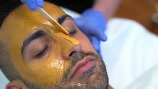 Removing Dark Spots with Enlighten Peel | Melasma Treatment | Hyperpigmentation Treatment