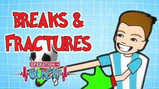 Bone Fractures & Breaks | Operation Ouch