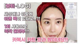 [뷰티-LOG] 세상에나 이렇게 아픈 팩이 있다고...?!?? 1회 사용으로 즉각 꿀피부!!! 카복시키트 효과 짱이네요!!