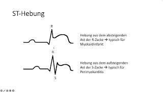 Klinische Skills 2: EKG Befundung Grundlagen