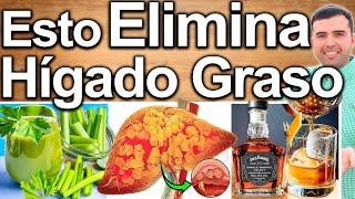 COMO ELIMINAR EL HIGADO GRASO 100%   DIETA, TIPS MAS EFECTIVOS QUE EXITEN NATURALES