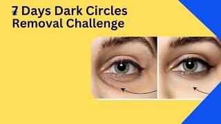 7 Days Dark Circles Removal Challenge ||Permanent Treatment