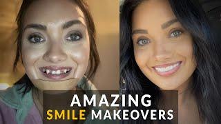 6 Shocking Cosmetic Smile Makeovers Designed WITHOUT A Dentist!