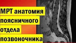 МРТ анатомия поясничного отдела позвоночника | Как выглядит позвоночник на МРТ