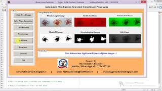 Matlab Code for Blood Group Detection and Classification Using Image Processing