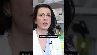 Stroke in young adults: Dr Alessandra Granata #Stroke #StrokeAwareness #Shorts