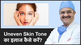 How To Treat Uneven Skin Tone (Uneven Skin Tone का इलाज कैसे करें) | ClearSkin, Pune | (In HINDI)