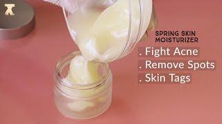 Fight acne, Remove dark spots, Remove skin tags with this homemade cream / Spring Skin Moisturiser