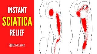 How to Instantly Fix Sciatica Pain