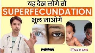 Superfoetation क्या है | Heteropaternal Superfecundation: Dr Anurag Prasad (Hindi) | Dizygotic Twin