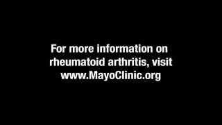 Drug Treatment for Rheumatoid Arthritis