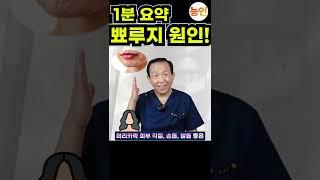 얼굴에 나는 고름, 표피낭종, 뾰루지, 여드름의 원인 1분 요약 영상 (feat. 자연치유학 해결방법) #shorts